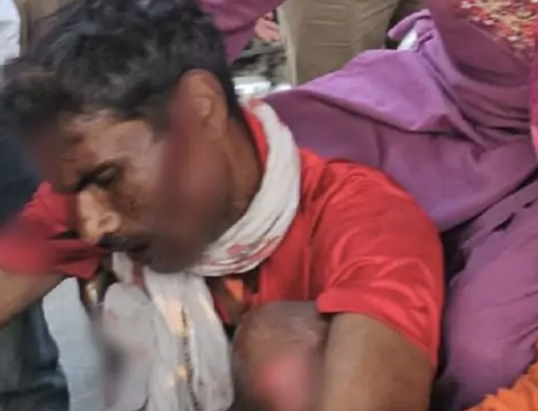 चाइनीज मांझा हादसा लखनऊ में घायल युवक की हालत गंभीर